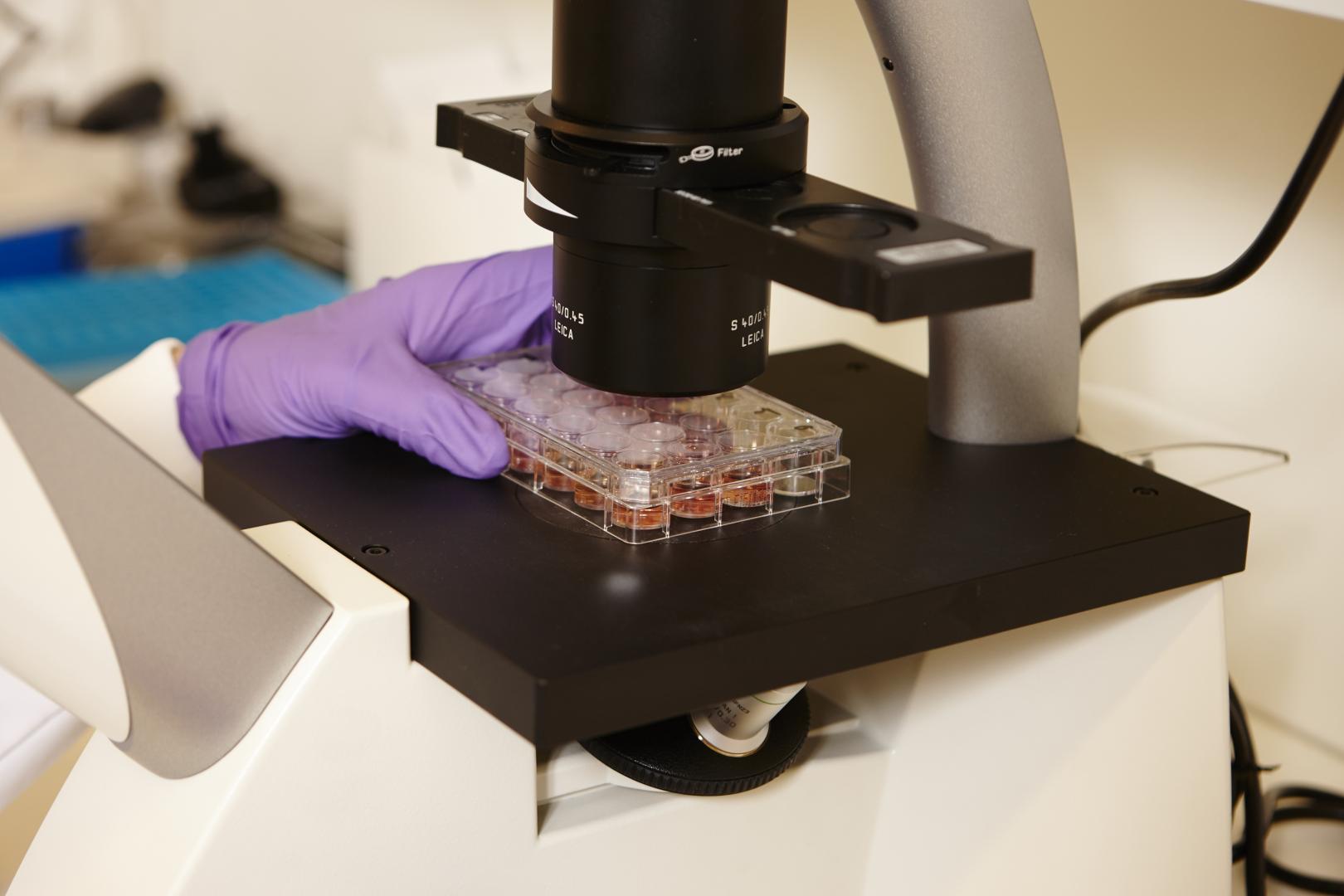 KiKa onderzoek kinderkanker microscoop lab